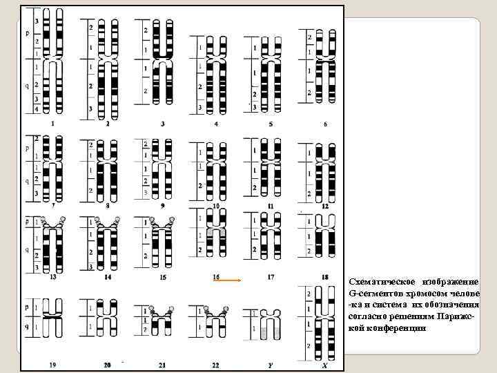 Схематическое изображение G-сегментов хромосом челове -ка и система их обозначения согласно решениям Парижской конференции