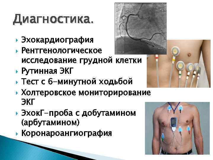 Рентгенологическая картина костного анкилоза внчс характеризуется