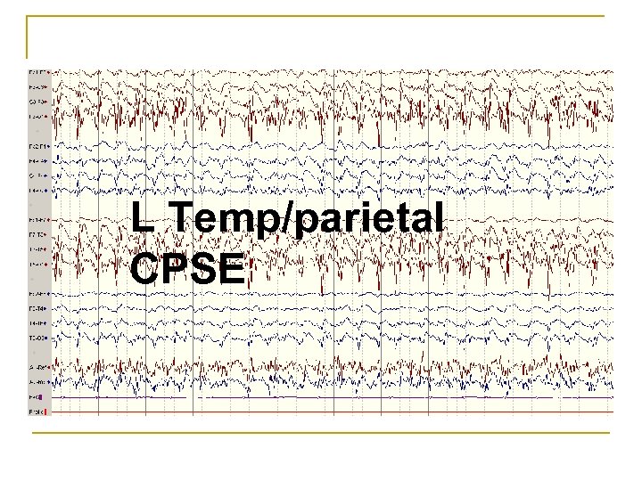 L Temp/parietal CPSE 