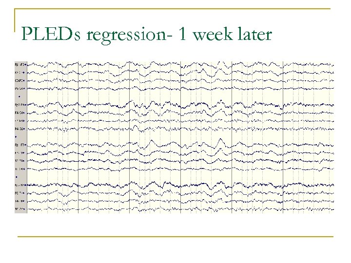 PLEDs regression- 1 week later 