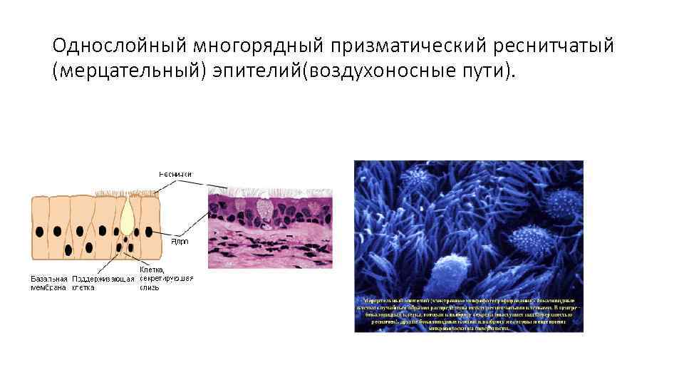 Однослойный многорядный призматический реснитчатый (мерцательный) эпителий(воздухоносные пути). 