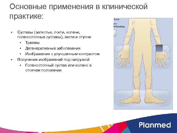 Основные применения в клинической практике: • • Суставы (запястья, локти, колени, голеностопные суставы), кисти