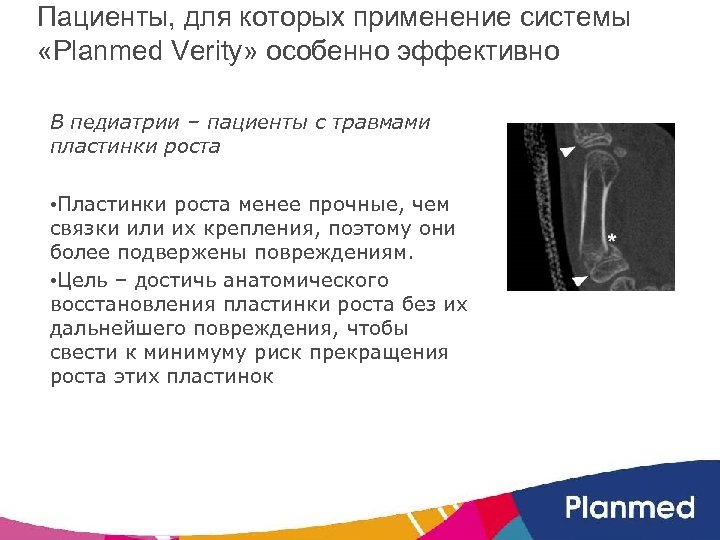 Пациенты, для которых применение системы «Planmed Verity» особенно эффективно В педиатрии – пациенты с