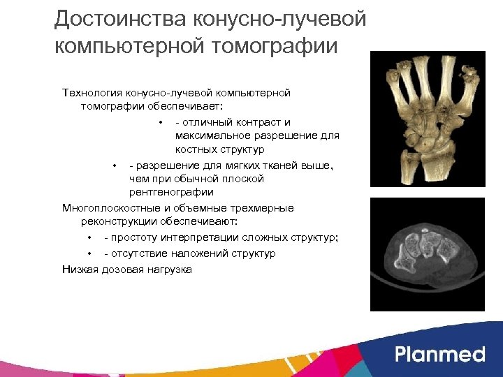 Достоинства конусно-лучевой компьютерной томографии Технология конусно-лучевой компьютерной томографии обеспечивает: • - отличный контраст и