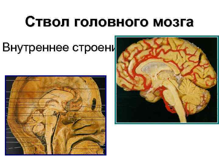 Ствол головного мозга Внутреннее строение 