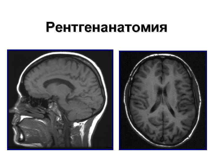 Рентгенанатомия 