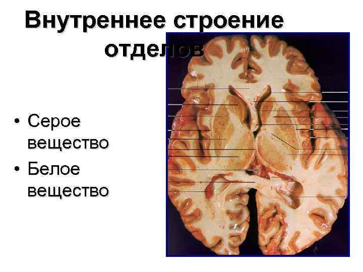 Внутреннее строение отделов • Серое вещество • Белое вещество 