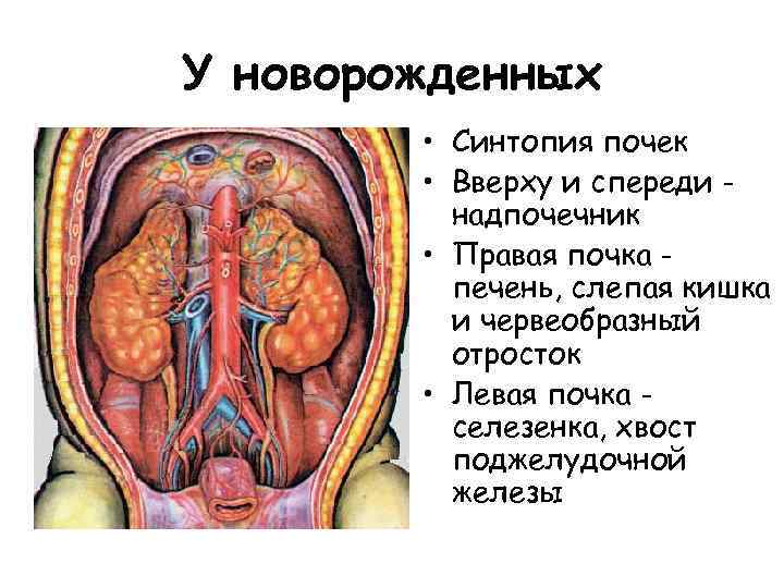 У новорожденных • Синтопия почек • Вверху и спереди надпочечник • Правая почка печень,