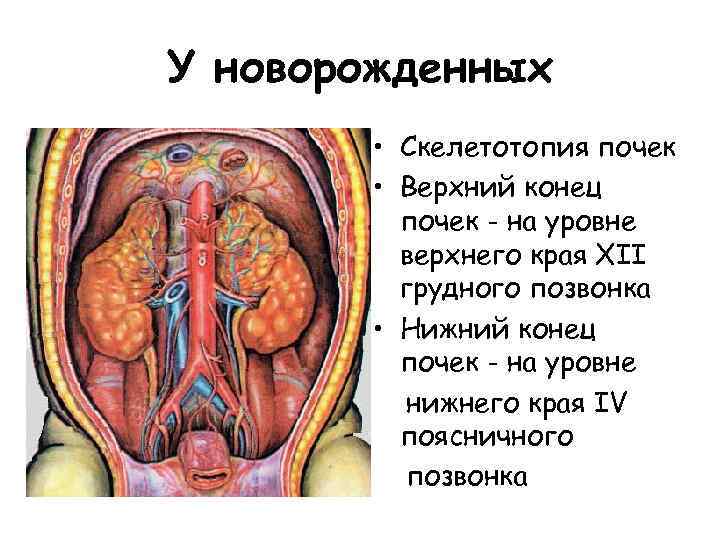 У новорожденных • Скелетотопия почек • Верхний конец почек - на уровне верхнего края