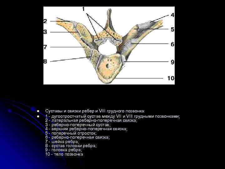 l l Суставы и связки ребер и VIII грудного позвонка: 1 - дугоотростчатый сустав