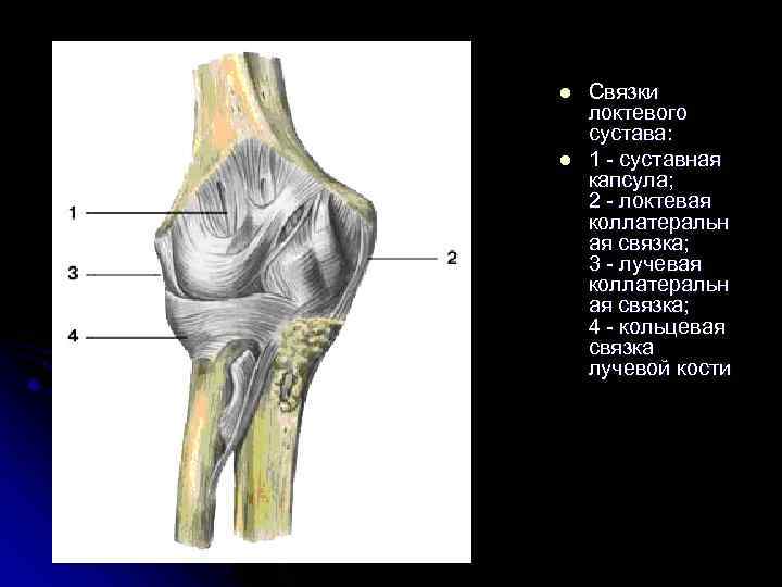 l l Связки локтевого сустава: 1 - суставная капсула; 2 - локтевая коллатеральн ая