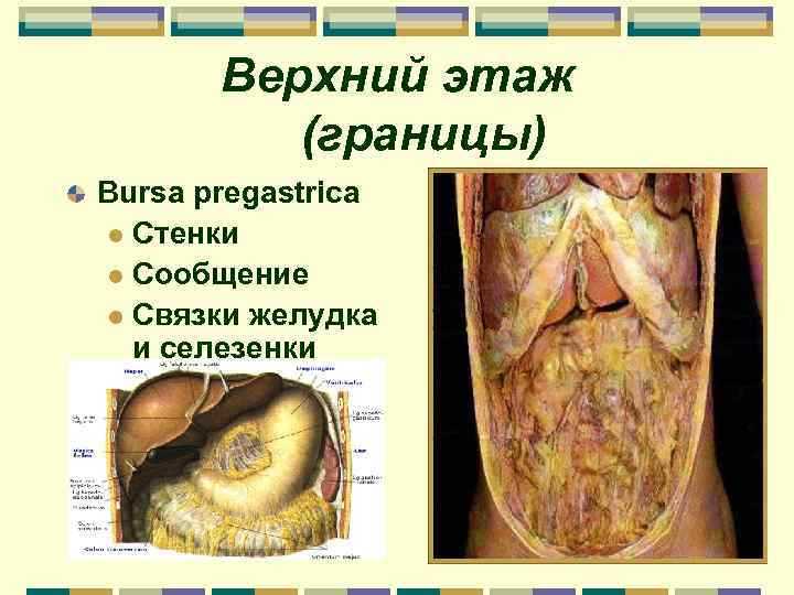 Верхний этаж (границы) Bursa pregastrica l Стенки l Сообщение l Связки желудка и селезенки