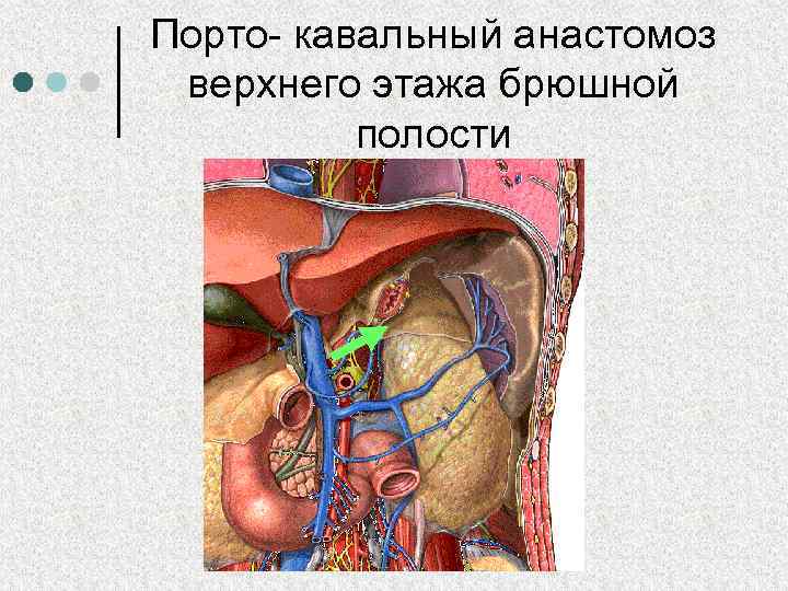 Порто кава. Околопупочная Вена анастомоз. Порто-кава-кавальный анастомоз схема. Кава кавальные и портокавальные анастомозы. Венозные анастомозы брюшной полости.