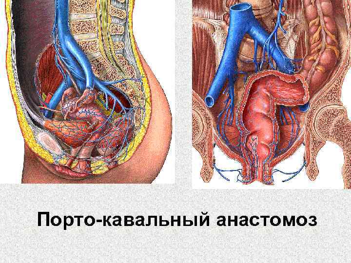 Порто-кавальный анастомоз 