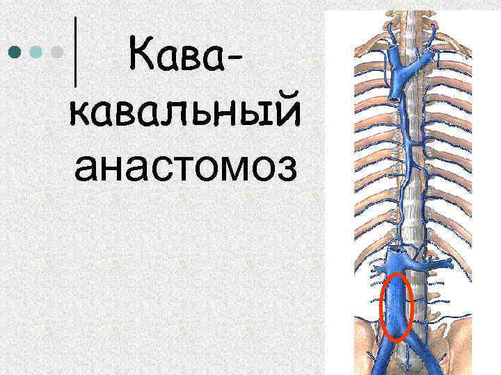 Кава кавальные анастомозы. Полунепарная Вена анатомия. Екпарная полунепарная Вена. Кавакавальные анастомозы. Кава кавальные анастомозы анатомия.