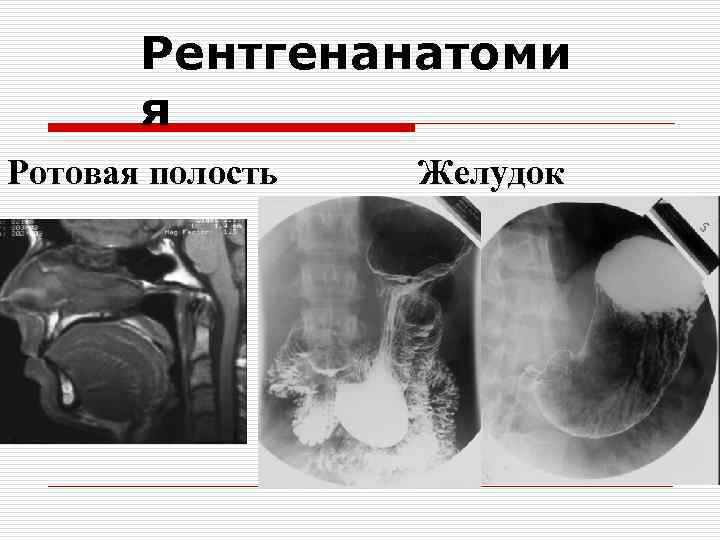 Рентгенанатоми я Ротовая полость Желудок 