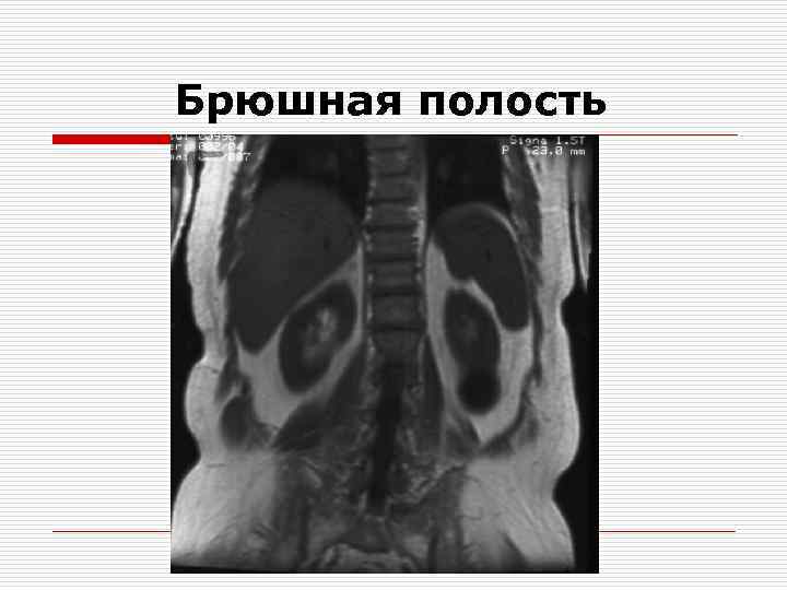 Брюшная полость 