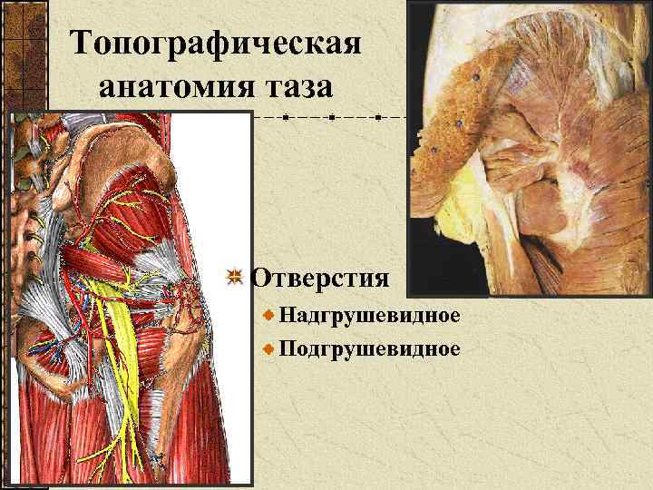 Топографическая анатомия таза Отверстия Надгрушевидное Подгрушевидное 