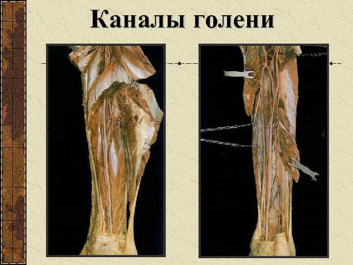 Каналы голени 