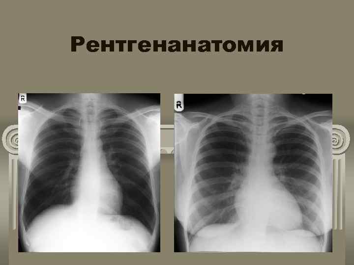 Рентгенанатомия 