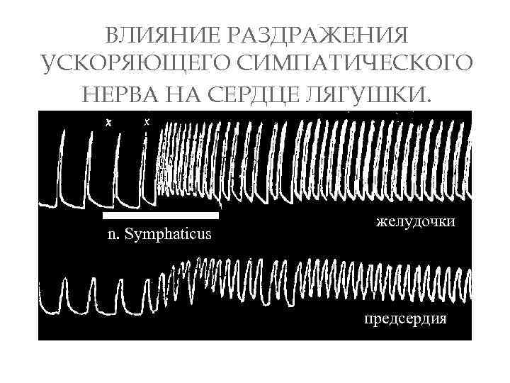 ВЛИЯНИЕ РАЗДРАЖЕНИЯ УСКОРЯЮЩЕГО СИМПАТИЧЕСКОГО НЕРВА НА СЕРДЦЕ ЛЯГУШКИ. n. Symphaticus желудочки предсердия 