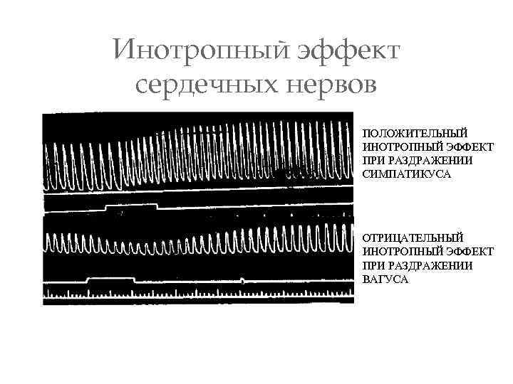 Инотропный эффект сердечных нервов ПОЛОЖИТЕЛЬНЫЙ ИНОТРОПНЫЙ ЭФФЕКТ ПРИ РАЗДРАЖЕНИИ СИМПАТИКУСА ОТРИЦАТЕЛЬНЫЙ ИНОТРОПНЫЙ ЭФФЕКТ ПРИ