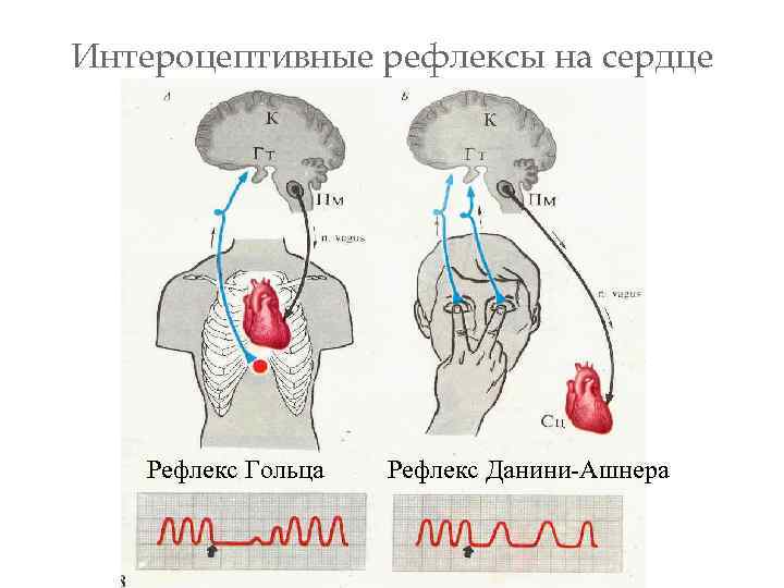 Интероцептивные рефлексы на сердце Рефлекс Гольца Рефлекс Данини-Ашнера 