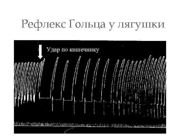 Рефлекс Гольца у лягушки Удар по кишечнику 