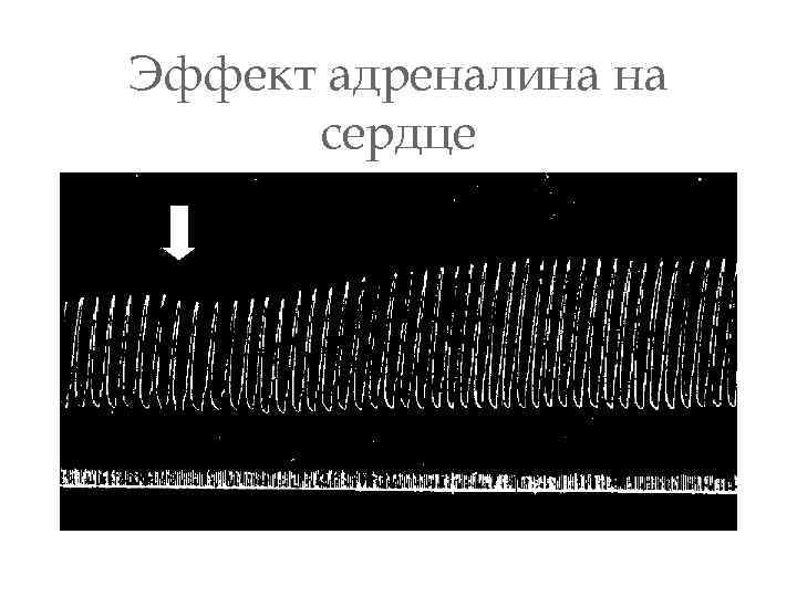 Эффект адреналина на сердце 