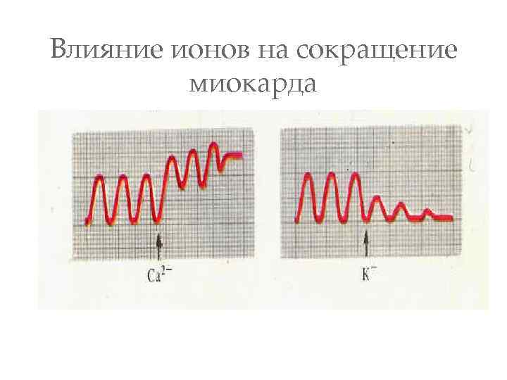 Влияние ионов на сокращение миокарда 