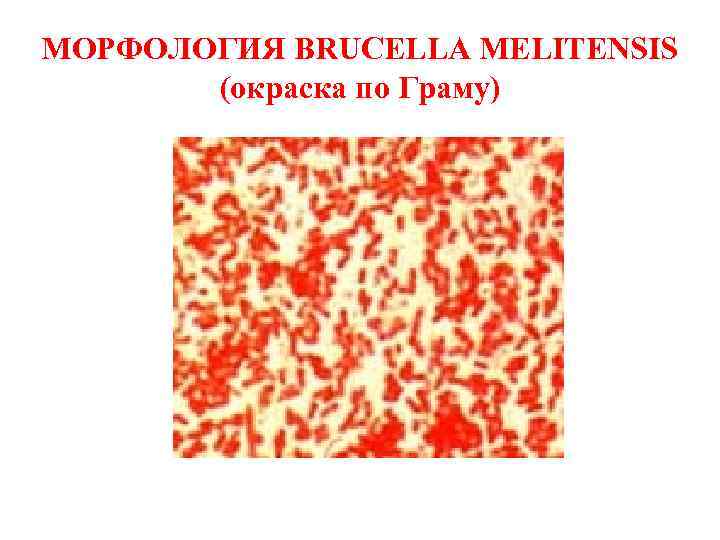 МОРФОЛОГИЯ BRUCELLA MELITENSIS (окраска по Граму) 