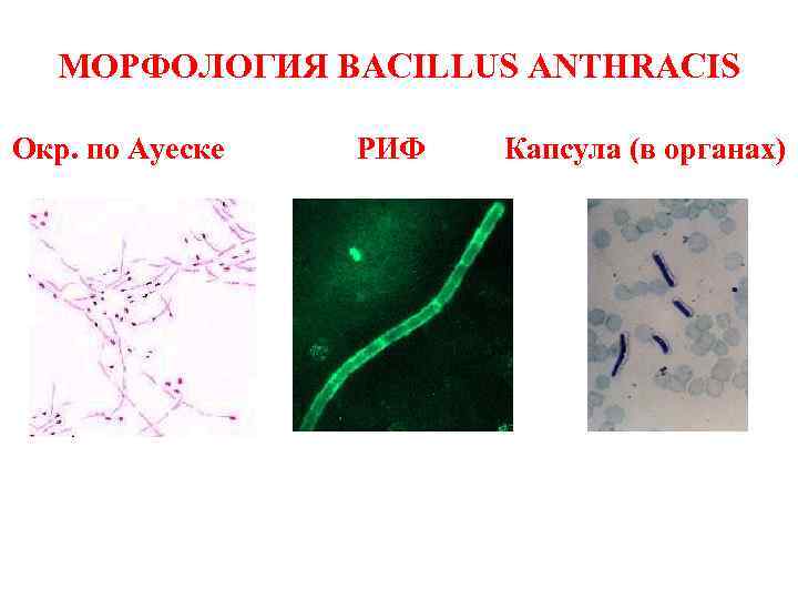 МОРФОЛОГИЯ BACILLUS ANTHRACIS Окр. по Ауеске РИФ Капсула (в органах) 