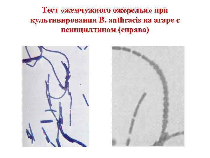 Тест «жемчужного ожерелья» при культивировании B. anthracis на агаре с пенициллином (справа) 