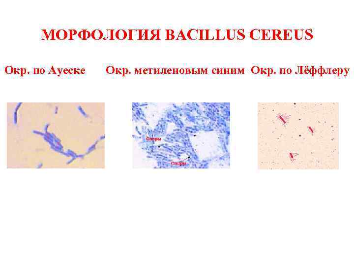 МОРФОЛОГИЯ BACILLUS CEREUS Окр. по Ауеске Окр. метиленовым синим Окр. по Лёффлеру 