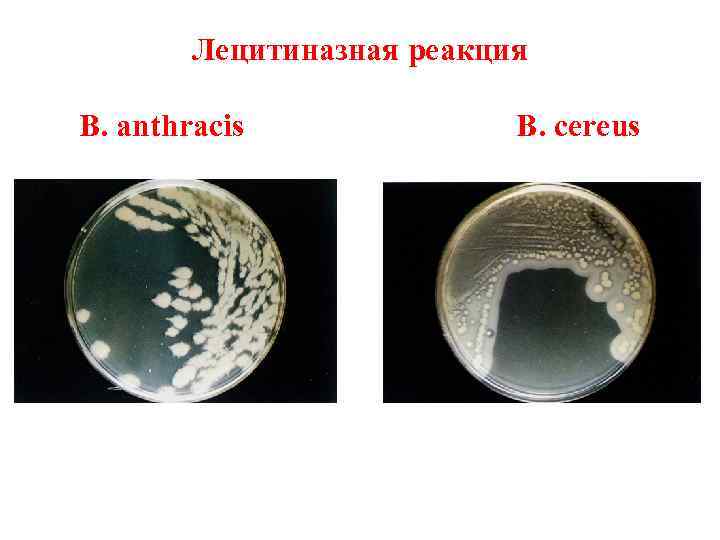 Лецитиназная реакция B. anthracis B. cereus 
