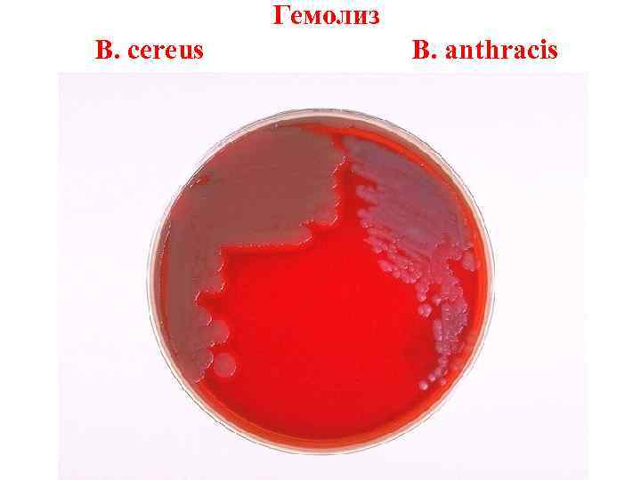 Гемолиз B. cereus B. anthracis 