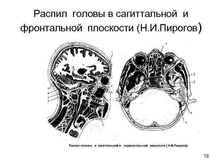 Распил головы в сагиттальной и фронтальной плоскости (Н. И. Пирогов) 19 