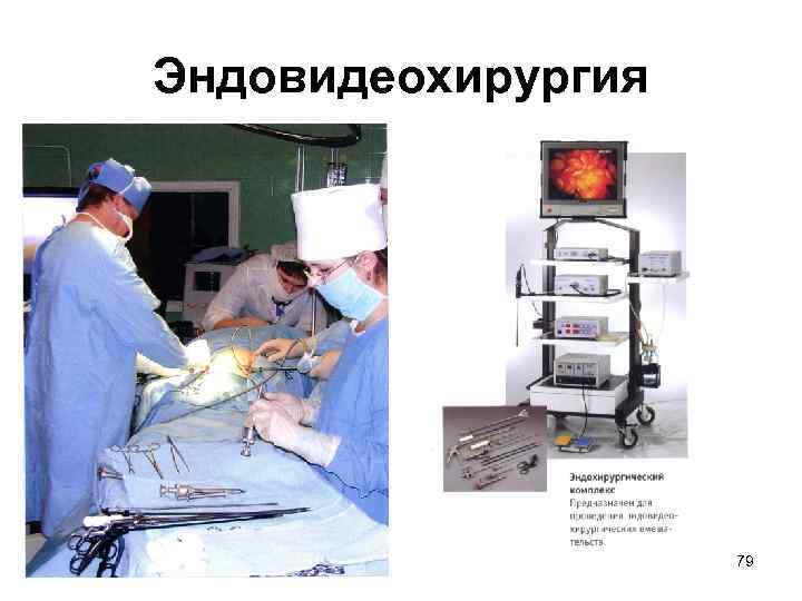 Эндовидеохирургия 79 
