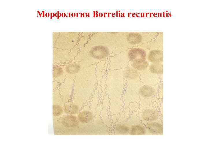 Морфология Borrelia recurrentis 