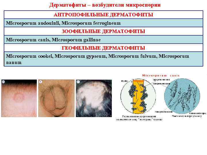 Дерматофиты – возбудители микроспории АНТРОПОФИЛЬНЫЕ ДЕРМАТОФИТЫ Microsporum audouinii, Microsporum ferrogineum ЗООФИЛЬНЫЕ ДЕРМАТОФИТЫ Microsporum canis,