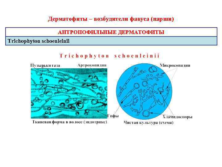 Дерматофиты – возбудители фавуса (парши) АНТРОПОФИЛЬНЫЕ ДЕРМАТОФИТЫ Trichophyton schoenleinii 