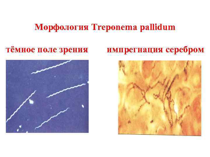 Морфология Treponema pallidum тёмное поле зрения импрегнация серебром 