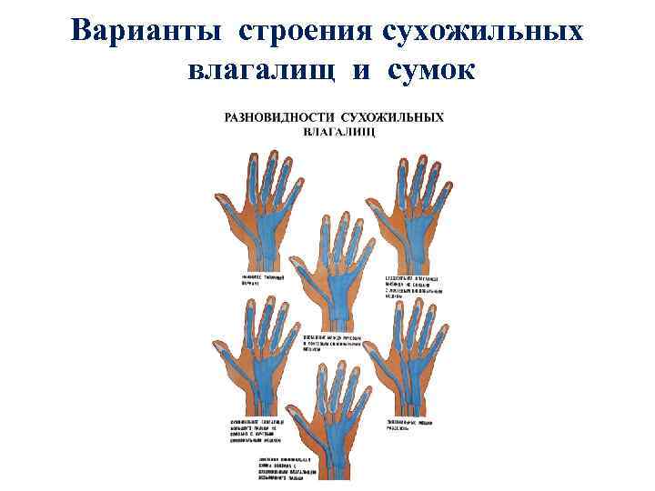 Варианты строения сухожильных влагалищ и сумок 