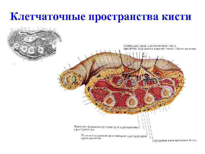 Поперечный распил кисти схема топографическая анатомия