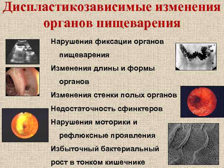 Диспластикозависимые изменения органов пищеварения Нарушения фиксации органов пищеварения Изменения длины и формы органов Изменения