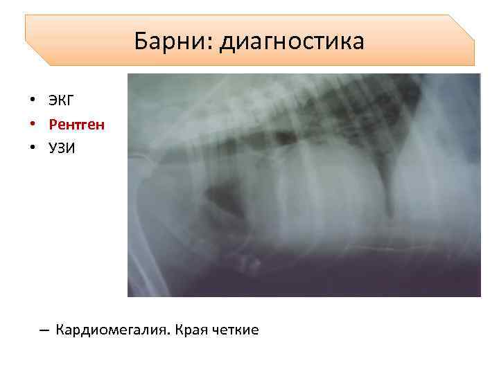 Барни: диагностика • ЭКГ • Рентген • УЗИ – Кардиомегалия. Края четкие 