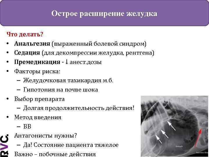 Острое расширение желудка Что делать? • Анальгезия (выраженный болевой синдром) • Седация (для декомпрессии