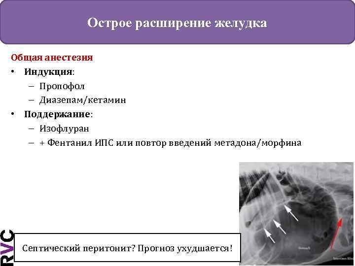 Острое расширение желудка Общая анестезия • Индукция: – Пропофол – Диазепам/кетамин • Поддержание: –