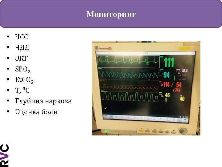 Мониторинг • • ЧСС ЧДД ЭКГ SPO 2 Et. CO 2 Т, 0 С