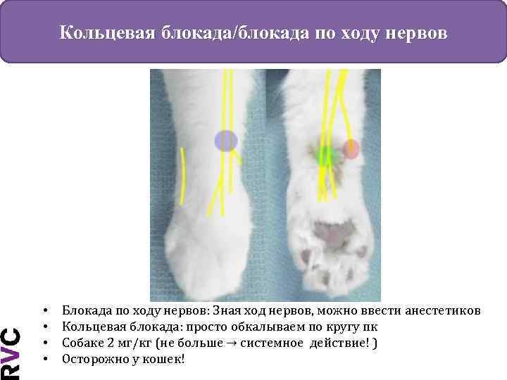 Кольцевая блокада/блокада по ходу нервов • • Блокада по ходу нервов: Зная ход нервов,